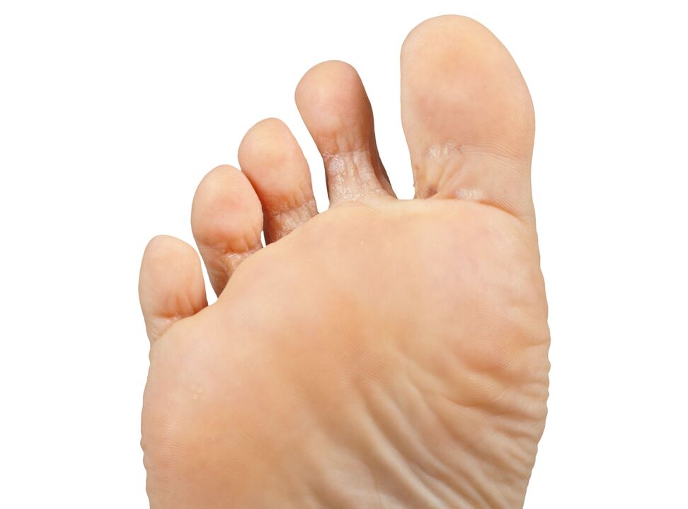 Funger-good and double-pair-heck-cream-smelter